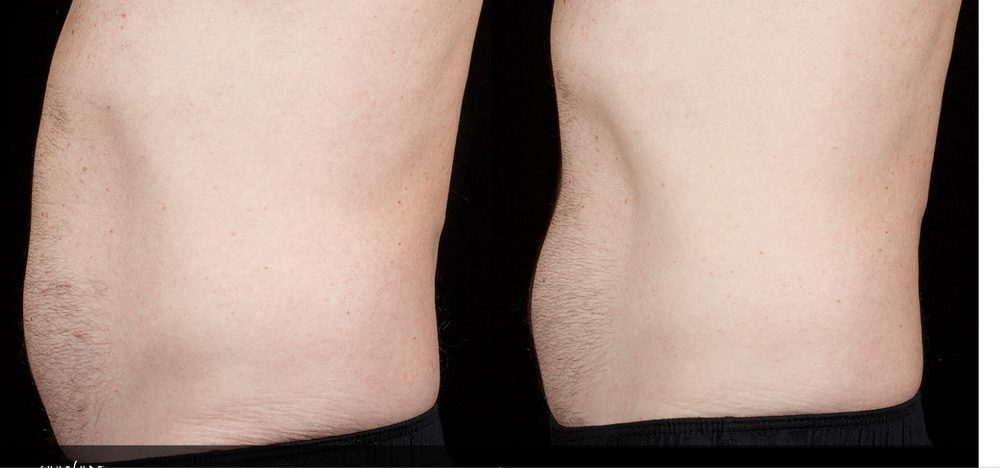 Before / After