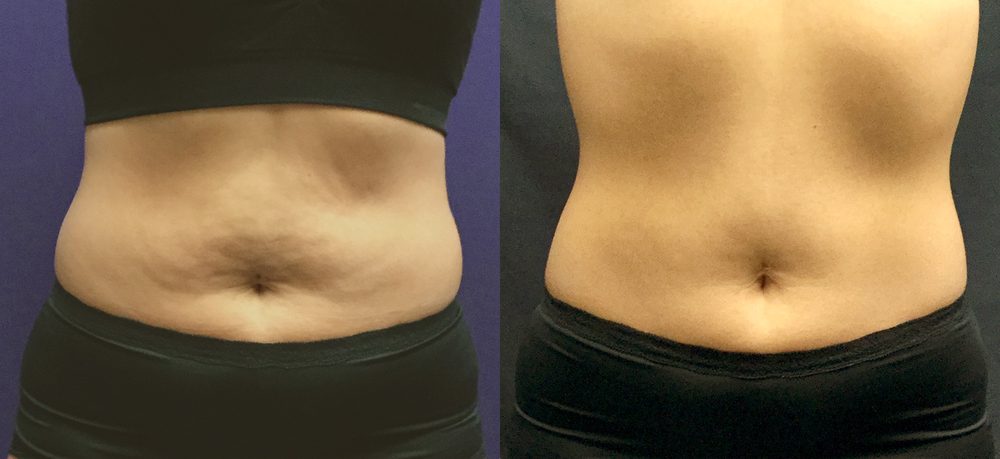 Before / After